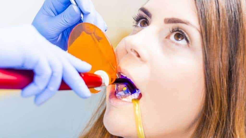 cosmetic bonding noblesville