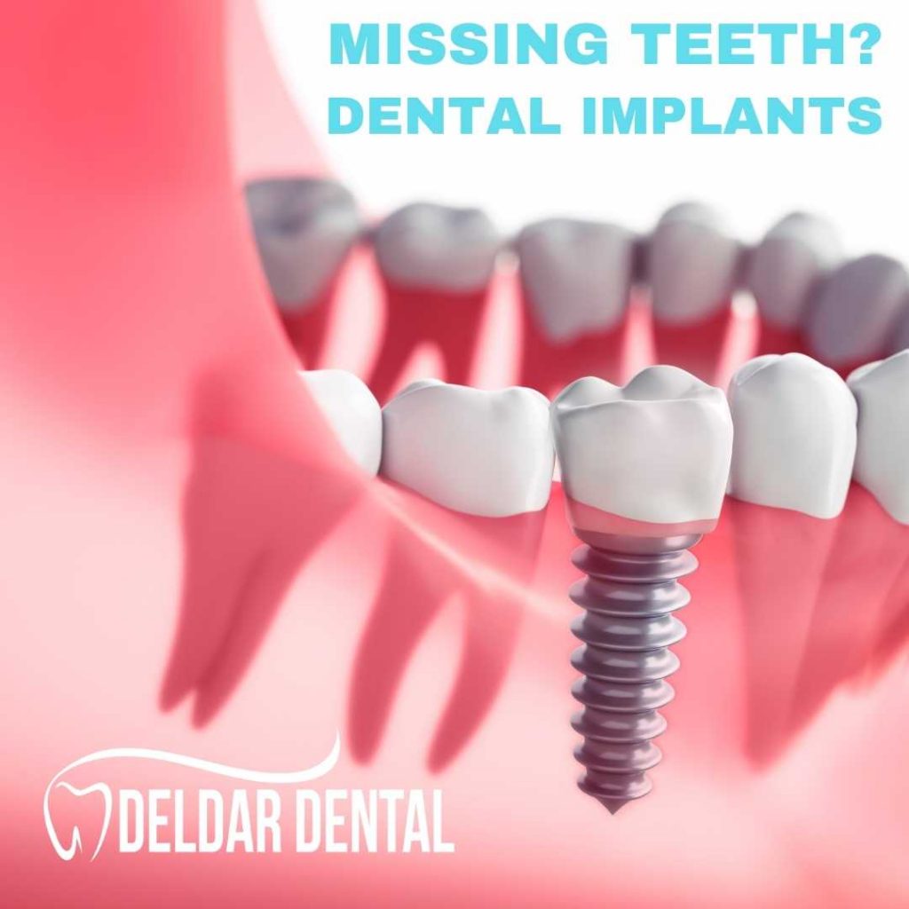 dental implants in indianapolis