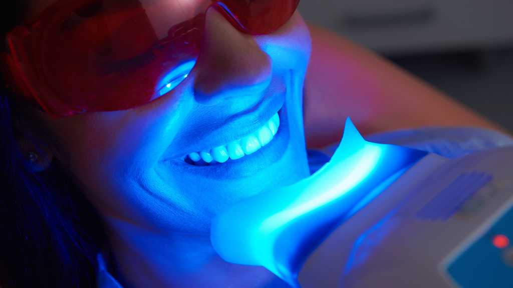 teeth-whitening-deldardental-noblesville