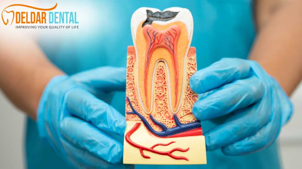 root-canal-deldardental-noblesville